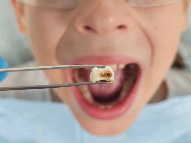 Emergency Dentist for Kids in SD